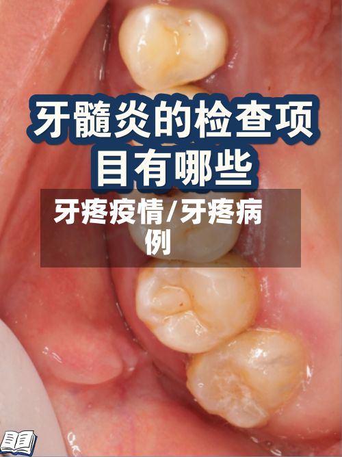 牙疼疫情/牙疼病例