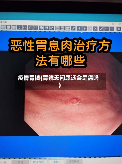 疫情胃镜(胃镜无问题还会是癌吗)-第3张图片