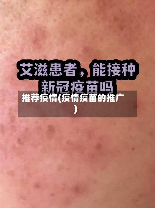 推荐疫情(疫情疫苗的推广)-第2张图片
